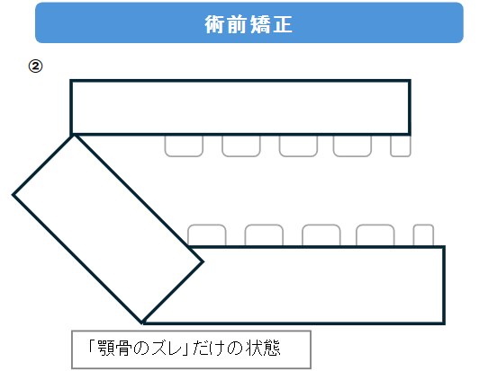 術前矯正による結果